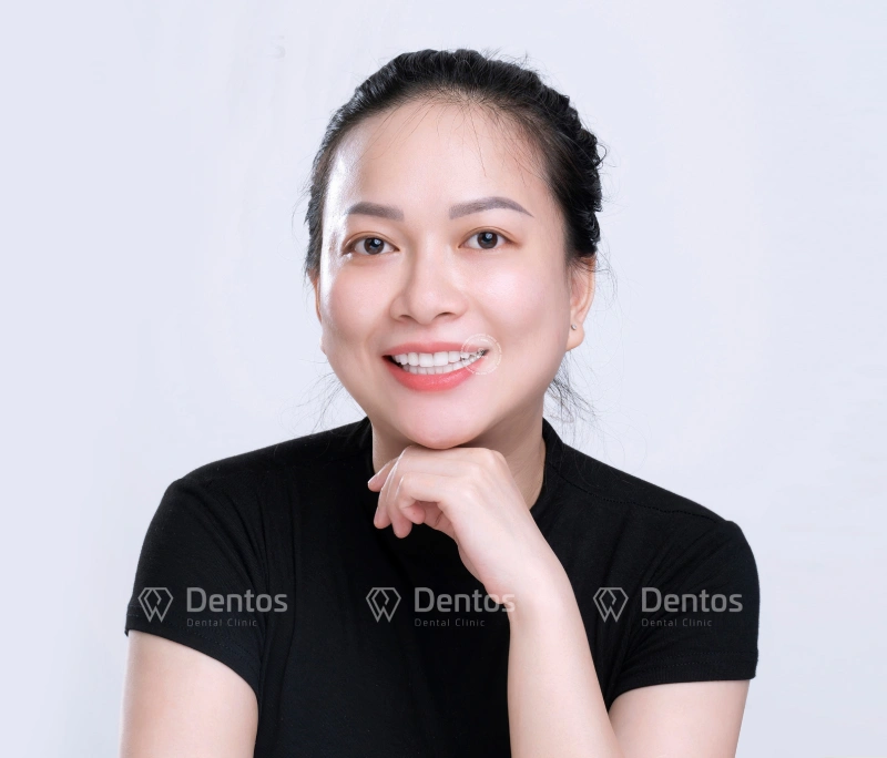 4 yếu tố then chốt quyết định răng bọc sứ dùng được bao lâu